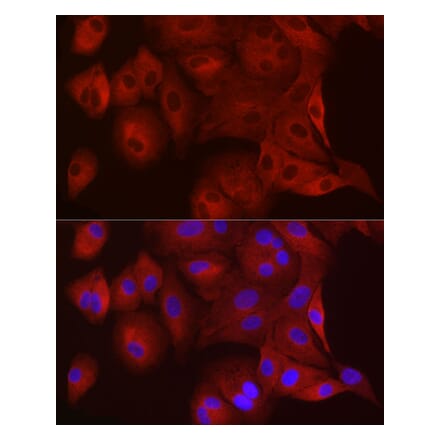 Immunofluorescence - Anti-WISP2 Antibody (A92758) - Antibodies.com