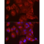 Immunofluorescence - Anti-WISP2 Antibody (A92758) - Antibodies.com