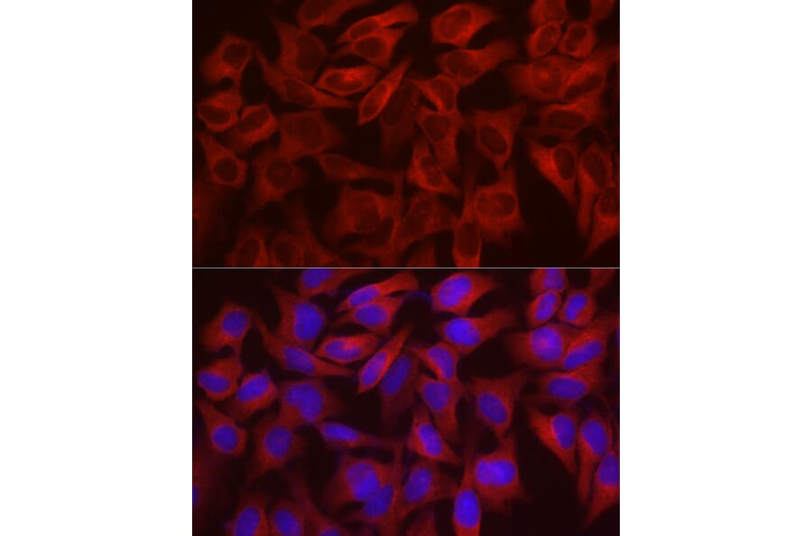 Immunofluorescence - Anti-WISP2 Antibody (A92758) - Antibodies.com