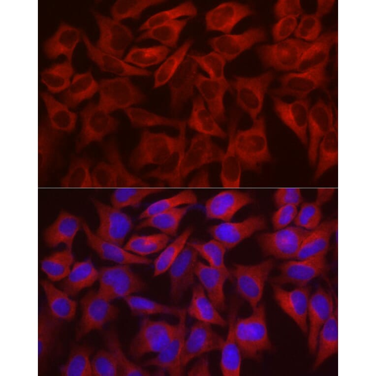 Immunofluorescence - Anti-WISP2 Antibody (A92758) - Antibodies.com