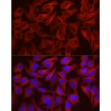 Immunofluorescence - Anti-WISP2 Antibody (A92758) - Antibodies.com