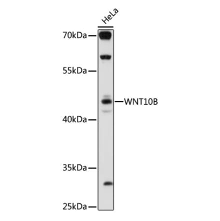 Western Blot - Anti-Wnt10b Antibody (A92759) - Antibodies.com