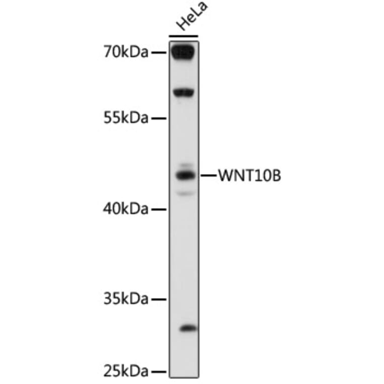 Western Blot - Anti-Wnt10b Antibody (A92759) - Antibodies.com