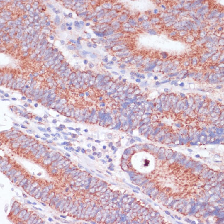 Immunohistochemistry - Anti-Wnt10b Antibody (A92759) - Antibodies.com