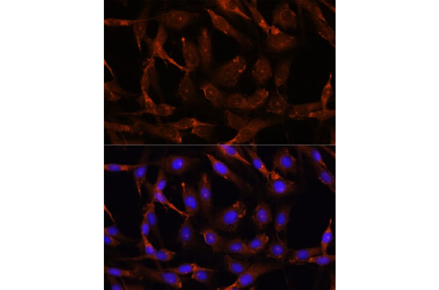 Immunofluorescence - Anti-Wnt10b Antibody (A92759) - Antibodies.com