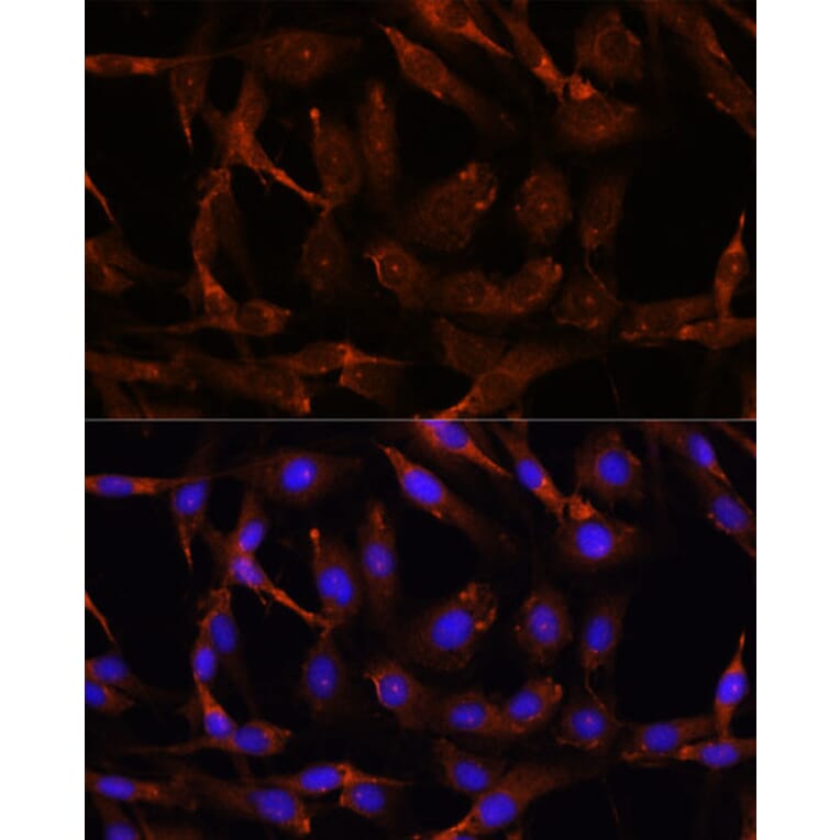 Immunofluorescence - Anti-Wnt10b Antibody (A92759) - Antibodies.com