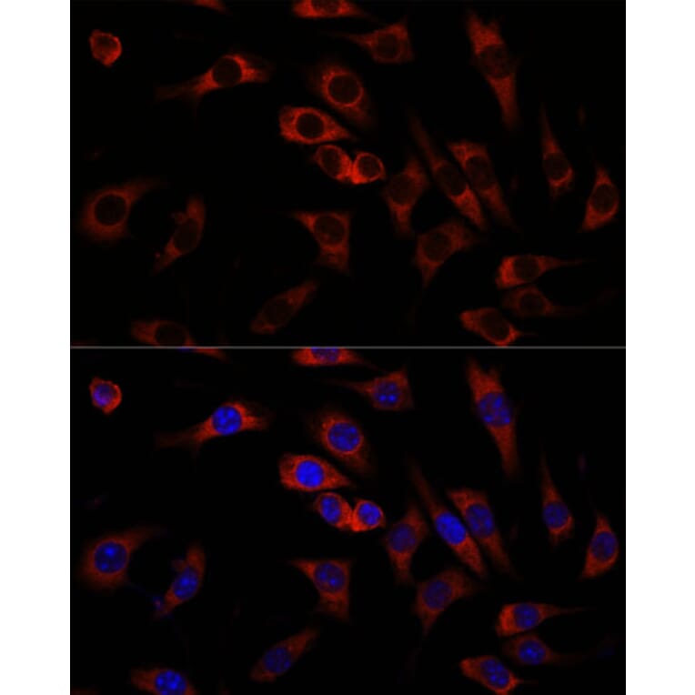 Immunofluorescence - Anti-Wnt10b Antibody (A92759) - Antibodies.com