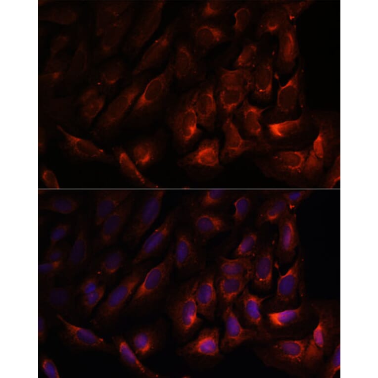 Immunofluorescence - Anti-Wnt10b Antibody (A92759) - Antibodies.com