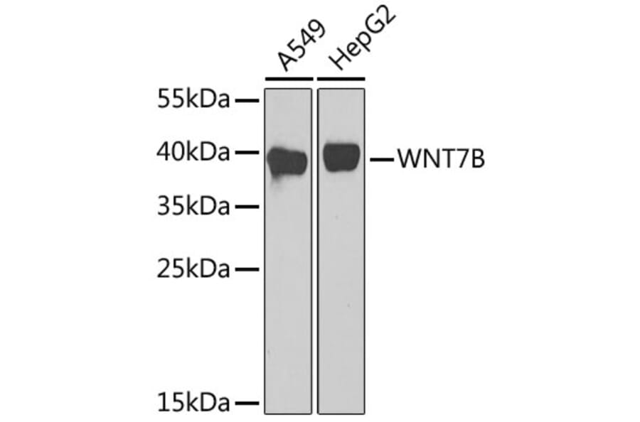 Western Blot - Anti-Wnt7b Antibody (A92760) - Antibodies.com