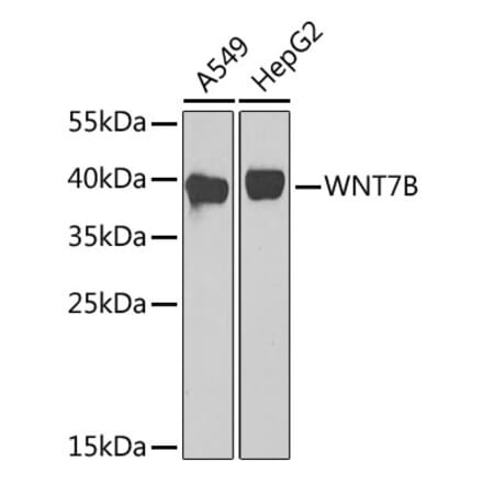 Western Blot - Anti-Wnt7b Antibody (A92760) - Antibodies.com
