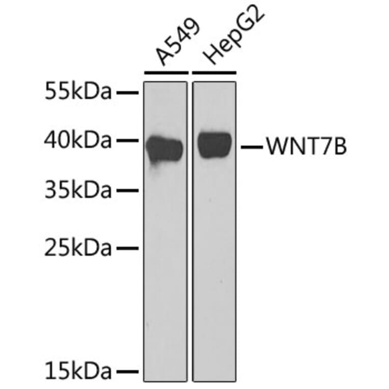 Western Blot - Anti-Wnt7b Antibody (A92760) - Antibodies.com