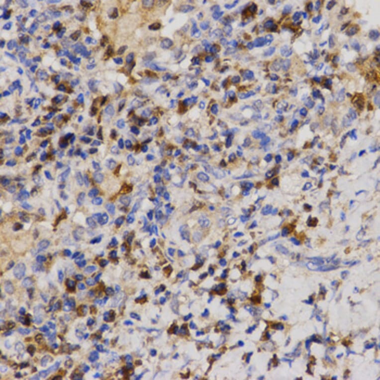 Immunohistochemistry - Anti-Eif2ak2 Antibody (A13583) - Antibodies.com