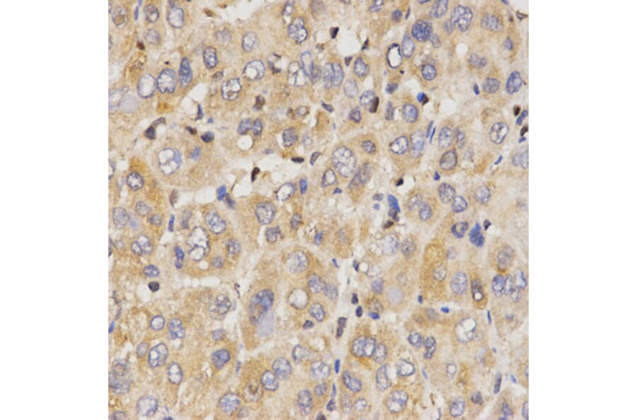 Immunohistochemistry - Anti-Eif2ak2 Antibody (A13583) - Antibodies.com