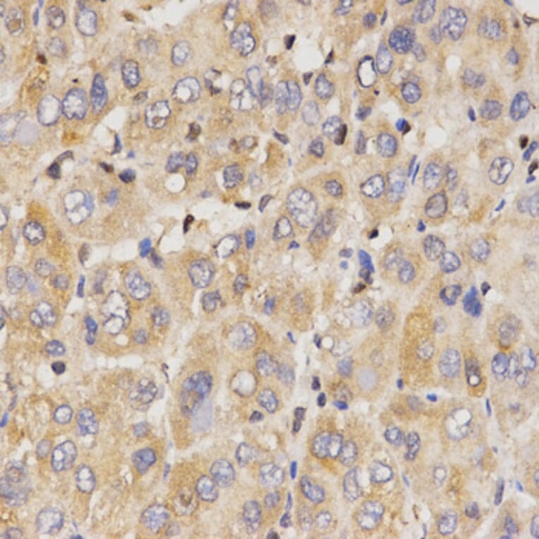 Immunohistochemistry - Anti-Eif2ak2 Antibody (A13583) - Antibodies.com
