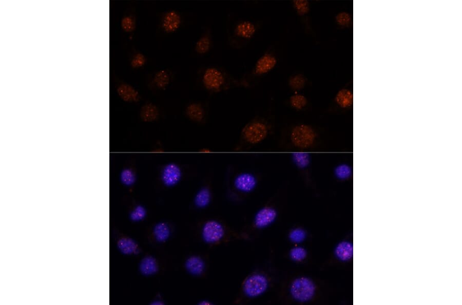 Immunofluorescence - Anti-GLI2 Antibody (A16864) - Antibodies.com