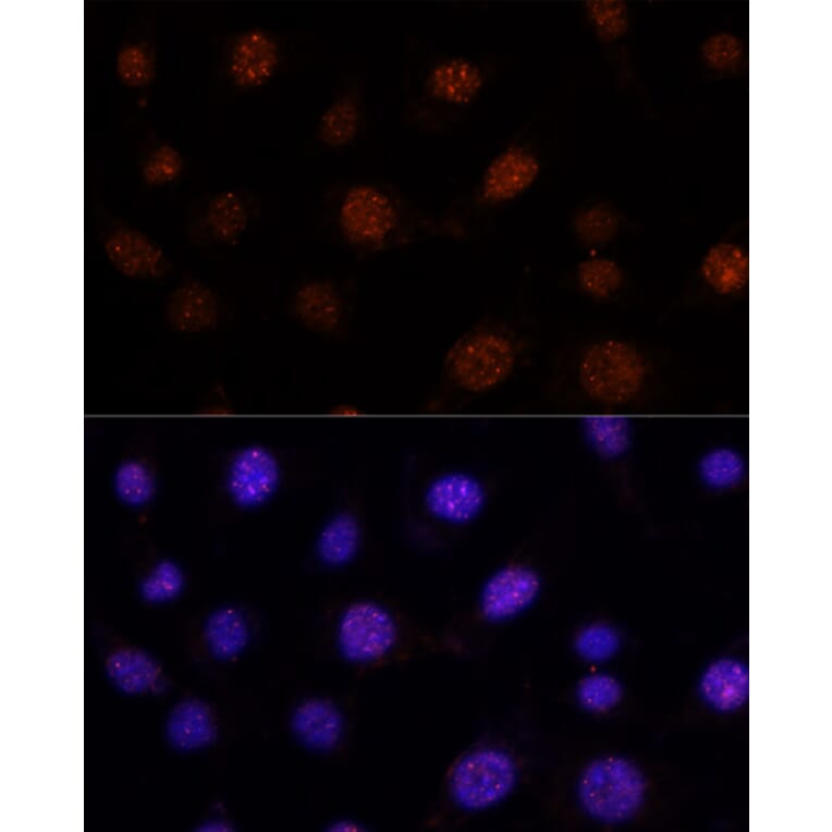 Immunofluorescence - Anti-GLI2 Antibody (A16864) - Antibodies.com