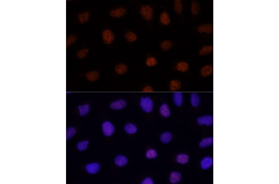 Immunofluorescence - Anti-GLI2 Antibody (A16864) - Antibodies.com