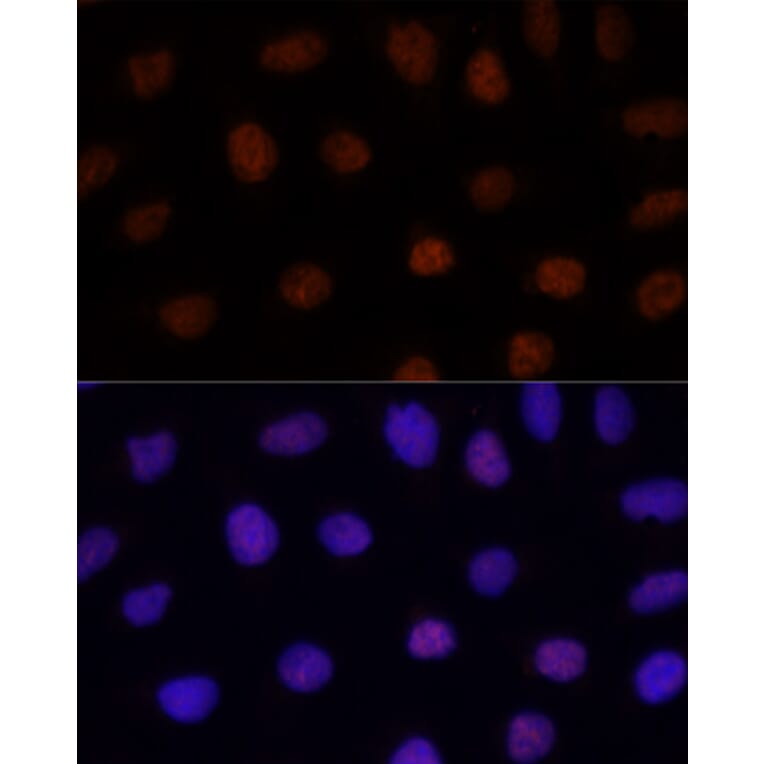 Immunofluorescence - Anti-GLI2 Antibody (A16864) - Antibodies.com
