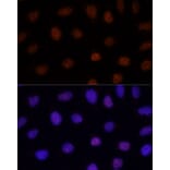 Immunofluorescence - Anti-GLI2 Antibody (A16864) - Antibodies.com