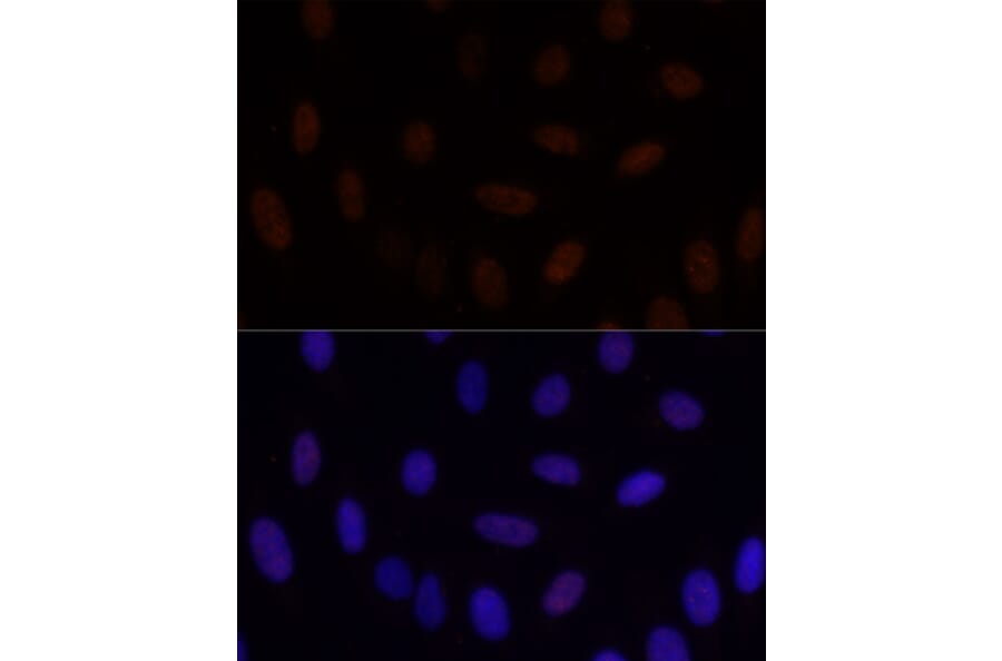Immunofluorescence - Anti-GLI2 Antibody (A16864) - Antibodies.com