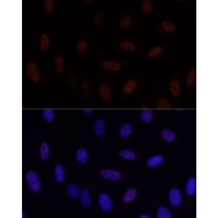 Immunofluorescence - Anti-GLI2 Antibody (A16864) - Antibodies.com