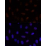 Immunofluorescence - Anti-GLI2 Antibody (A16864) - Antibodies.com