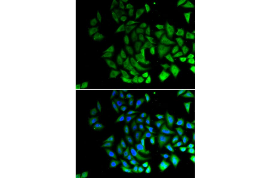 Immunofluorescence - Anti-PIWIL1 Antibody (A12349) - Antibodies.com