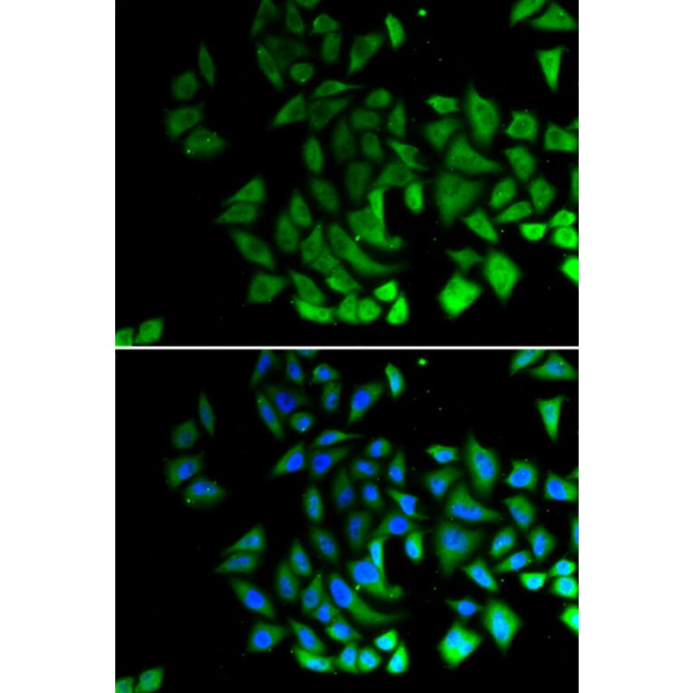 Immunofluorescence - Anti-PIWIL1 Antibody (A12349) - Antibodies.com