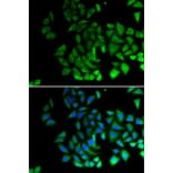 Immunofluorescence - Anti-PIWIL1 Antibody (A12349) - Antibodies.com