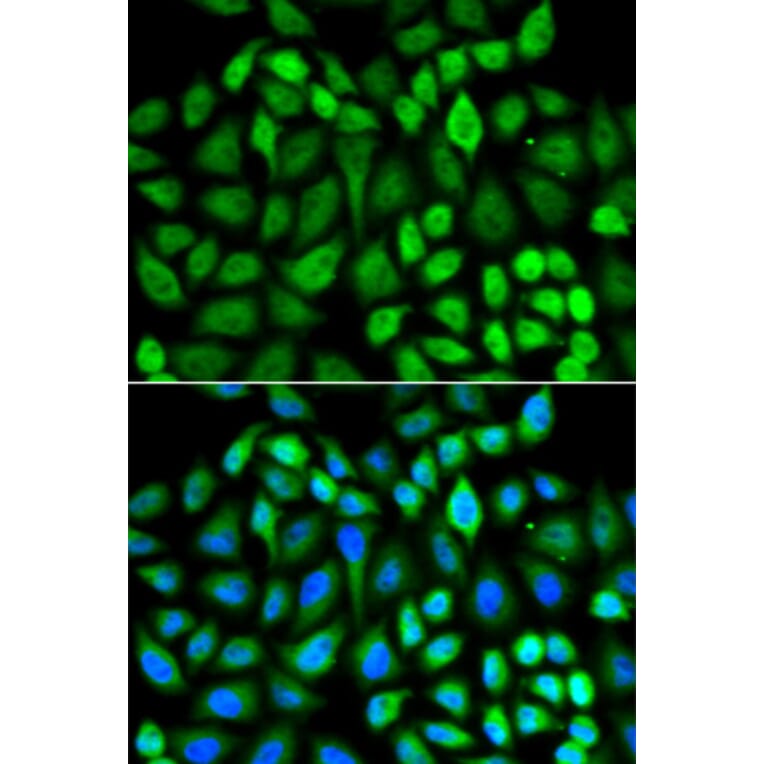 Immunofluorescence - Anti-MAPK3 Antibody (A13343) - Antibodies.com
