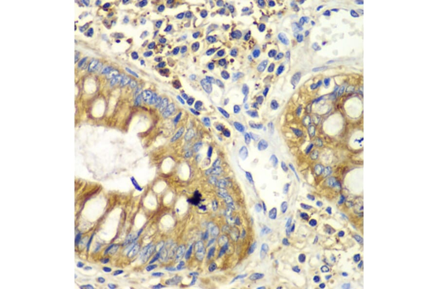 Immunohistochemistry - Anti-PICK1 Antibody (A92776) - Antibodies.com