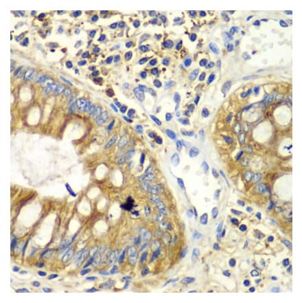 Immunohistochemistry - Anti-PICK1 Antibody (A92776) - Antibodies.com