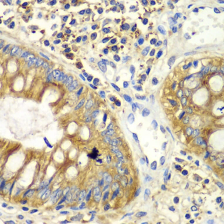 Immunohistochemistry - Anti-PICK1 Antibody (A92776) - Antibodies.com