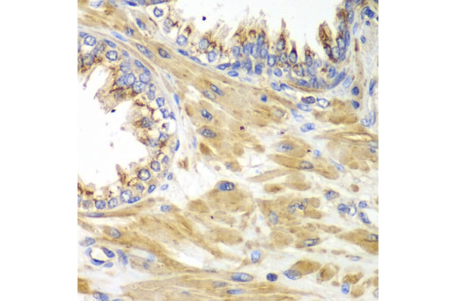 Immunohistochemistry - Anti-PICK1 Antibody (A92776) - Antibodies.com