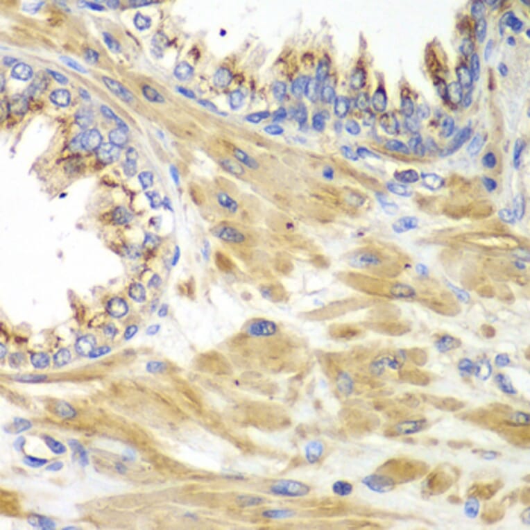 Immunohistochemistry - Anti-PICK1 Antibody (A92776) - Antibodies.com