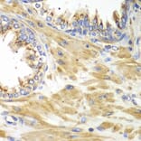 Immunohistochemistry - Anti-PICK1 Antibody (A92776) - Antibodies.com