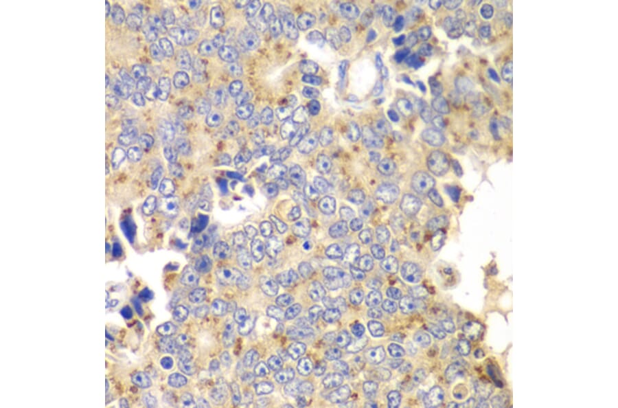Immunohistochemistry - Anti-PICK1 Antibody (A92776) - Antibodies.com