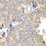 Immunohistochemistry - Anti-PICK1 Antibody (A92776) - Antibodies.com