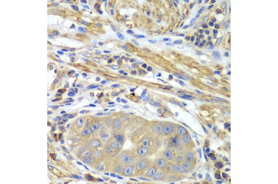 Immunohistochemistry - Anti-PICK1 Antibody (A92776) - Antibodies.com
