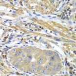 Immunohistochemistry - Anti-PICK1 Antibody (A92776) - Antibodies.com