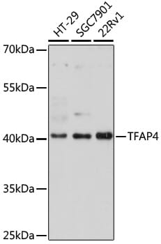 Western blot analysis of extracts of various cell lines, using Anti-TFAP4 Antibody (A16727) at 1:1,000 dilution.
Secondary antibody: Goat Anti-Rabbit IgG (H+L) (HRP) (AS014) at 1:10,000 dilution.
Lysates / proteins: 25µg per lane.
Blocking buffer: 3% non-fat dry milk in TBST.
Detection: ECL Basic Kit (RM00020).
Exposure time: 3min.