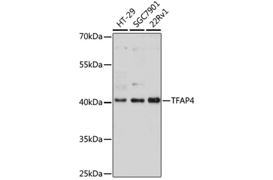 Western Blot - Anti-TFAP4 Antibody (A92777) - Antibodies.com