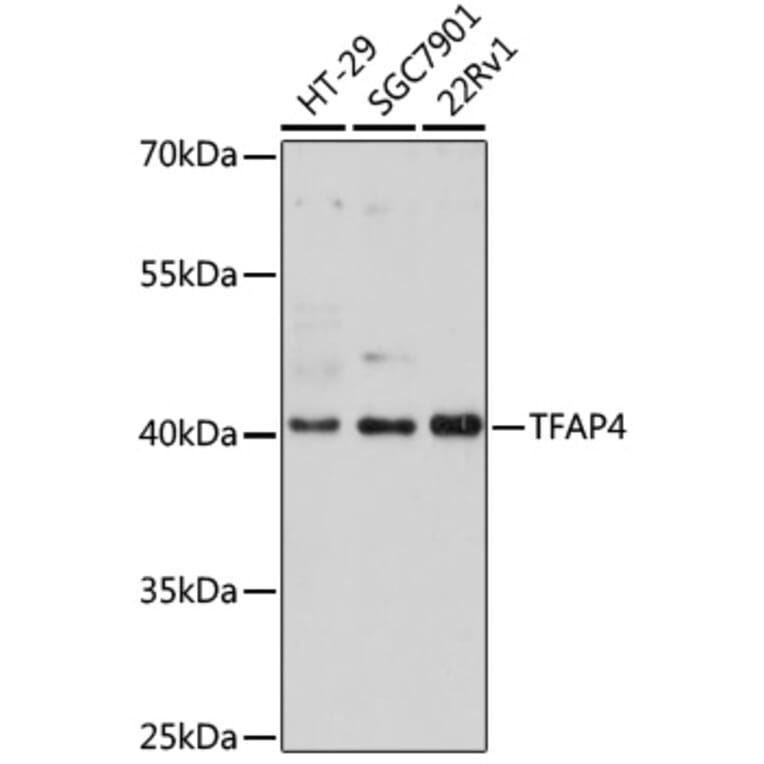 Western Blot - Anti-TFAP4 Antibody (A92777) - Antibodies.com