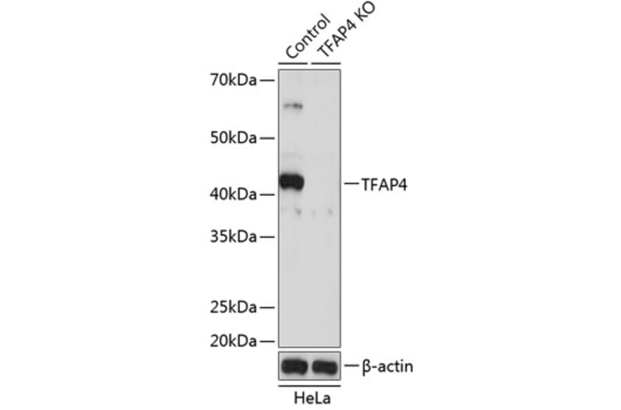 Western Blot - Anti-TFAP4 Antibody (A92777) - Antibodies.com