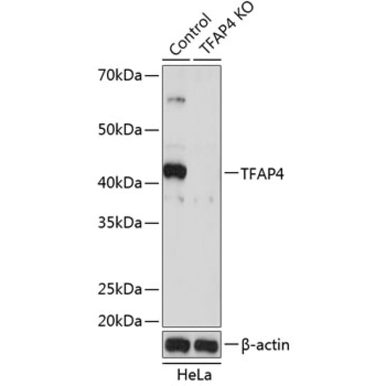 Western Blot - Anti-TFAP4 Antibody (A92777) - Antibodies.com