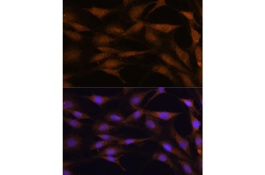 Immunofluorescence - Anti-TFAP4 Antibody (A92777) - Antibodies.com