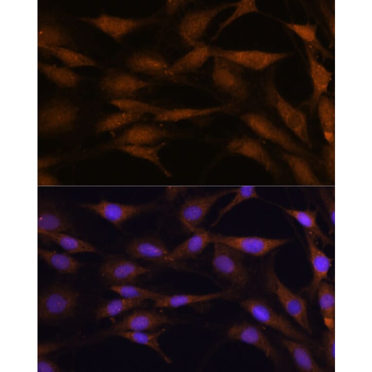 Immunofluorescence - Anti-TFAP4 Antibody (A92777) - Antibodies.com
