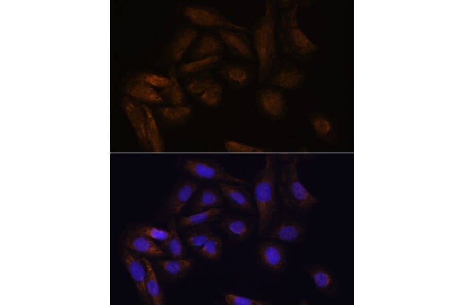Immunofluorescence - Anti-TFAP4 Antibody (A92777) - Antibodies.com