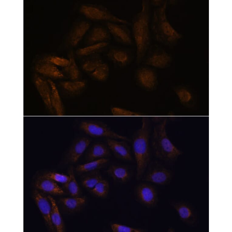 Immunofluorescence - Anti-TFAP4 Antibody (A92777) - Antibodies.com