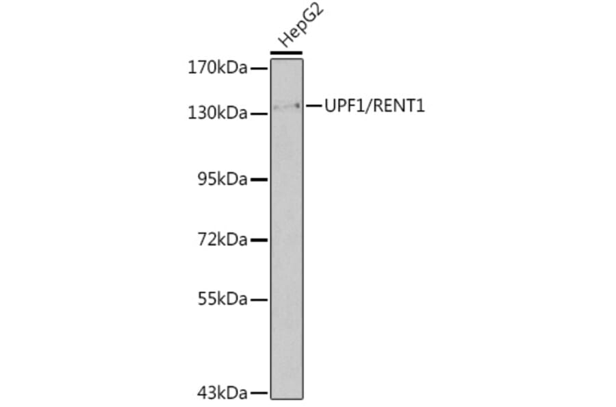 Western Blot - Anti-UPF1 Antibody (A92778) - Antibodies.com